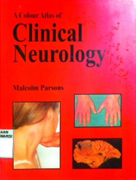 A colour atlas of clinical neurology - Opracowanie zbiorowe | Książka w ...