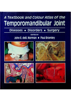 A textbook and colour atlas of the Temporomandibular Joint - John ...