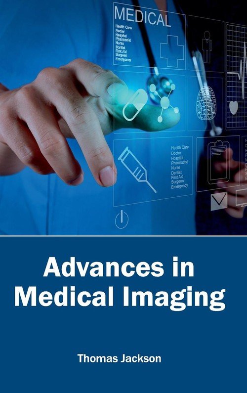 Advances In Medical Imaging - ML Books International - IPS | Książka W ...