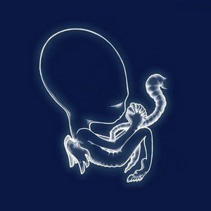 SIGUR RÓS – Agaetis Byrjun - A New Beginning (20th