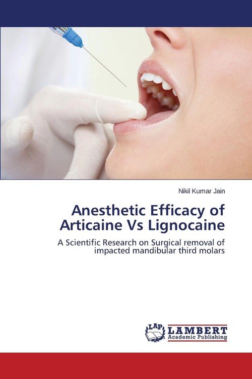 Anesthetic Efficacy Of Articaine Vs Lignocaine Jain Nikil Kumar Ksi Ka W Empik