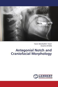 Antegonial Notch and Craniofacial Morphology - Abdulkadhim Yassir Yassir