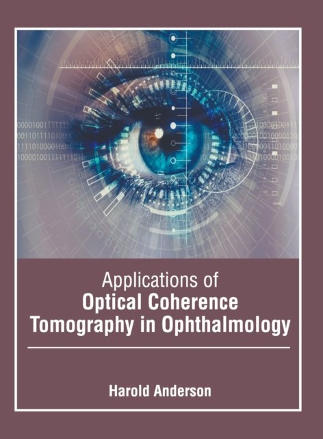 Applications Of Optical Coherence Tomography In Ophthalmology ...