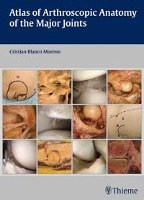Atlas of Arthroscopic Anatomy of Major Joints - Blanco Moreno Cristian