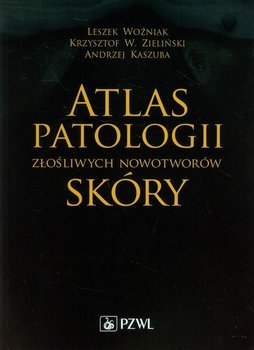 Atlas patologii złośliwych nowotworów skóry - Woźniak Leszek, Zieliński Krzysztof, Kaszuba Andrzej