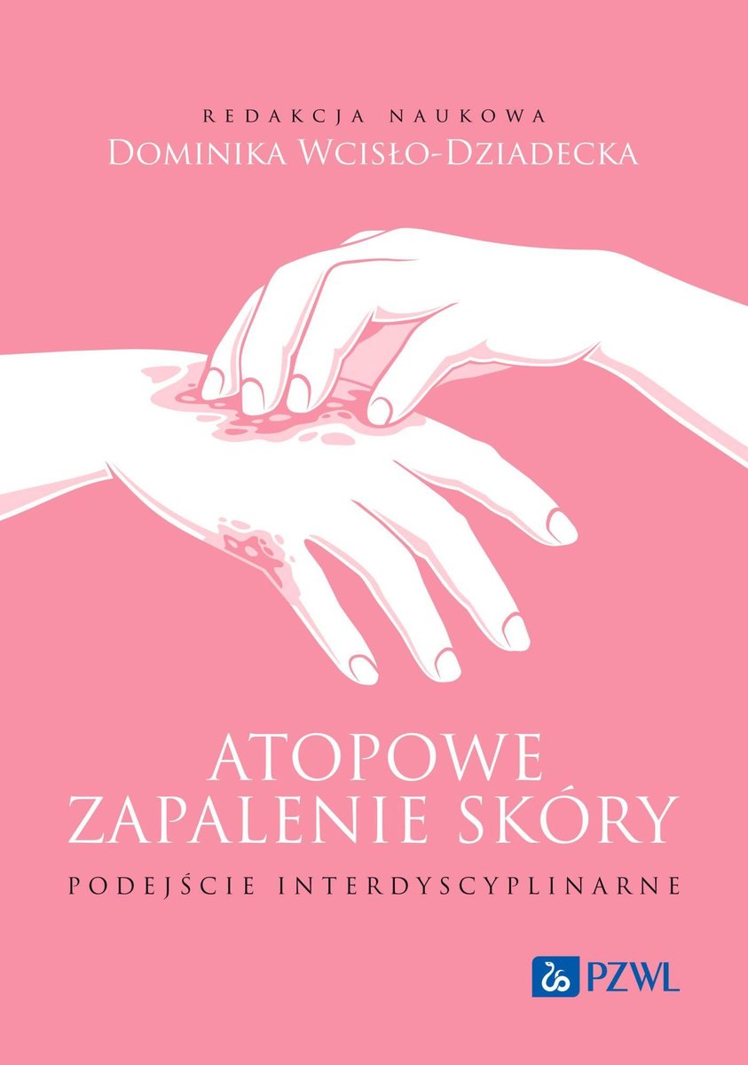 atopowe-zapalenie-sk-ry-podej-cie-interdyscyplinarne-dominika-wcis-o