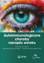 Autoimmunologiczne choroby narządu wzroku Romanowska-Dixon Bożena, Kubicka-Trząska Agnieszka
