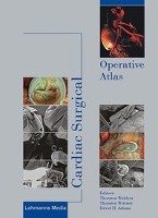 Cardiac Surgical Operative Atlas Lehmanns Media Gmbh, Lehmanns