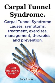 Carpal Tunnel Syndrome, Cts. Carpal Tunnel Syndrome Cts Causes, Symptoms, Treatment, Exercises, Management, Therapies and Prevention. - Rudford Lucy