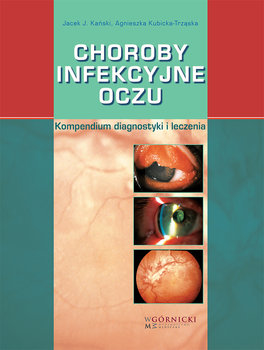 Choroby infekcyjne oczu. Kompendium diagnostyki i leczenia - Kański Jacek J., Kubicka-Trząska Agnieszka