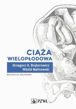 Ciąża wielopłodowa - Witold Malinowski, Bręborowicz Grzegorz H.