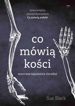 Co mówią kości. Mroczne tajemnice zbrodni - Black Sue