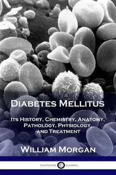 Diabetes Mellitus - Morgan William