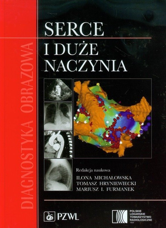 Diagnostyka Obrazowa Serce I Duże Naczynia Opracowanie Zbiorowe Książka W Empik 3539