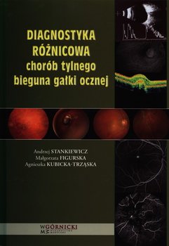 Diagnostyka różnicowa chorób tylnego bieguna gałki ocznej - Stankiewicz Andrzej, Figurska Małgorzata, Kubicka-Trząska Agnieszka