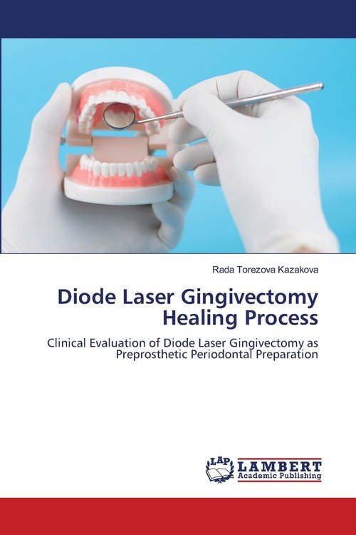 Diode Laser Gingivectomy Healing Process Kazakova Rada Torezova