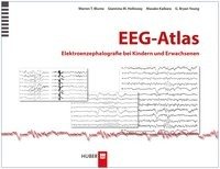 EEG-Atlas Blume Warren T., Kaibara Masako, Holloway Giannina M., Young Bryan G.