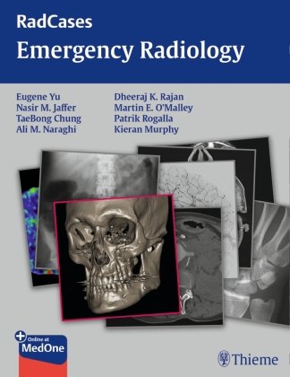 Emergency Radiology - Yu Eugene | Książka w Empik