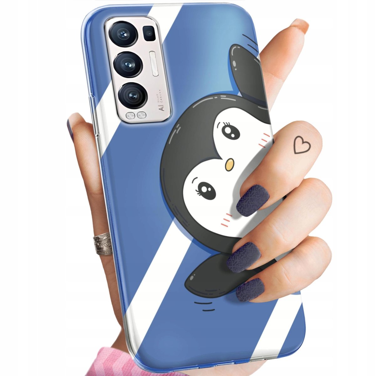 Protectores Oneplus Nord 2 Copatible Con Xiaoi I Ax3 Funda, Anillo Etálico Sujeción Soporte Oneplus Nord 4