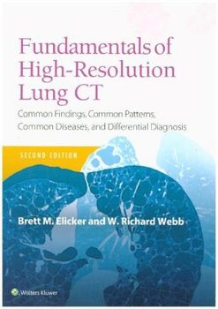 Fundamentals of High-Resolution Lung CT - Elicker Brett M., Webb Richard W.
