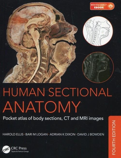 Human Sectional Anatomy: Pocket Atlas of Body Sections, CT and MRI ...