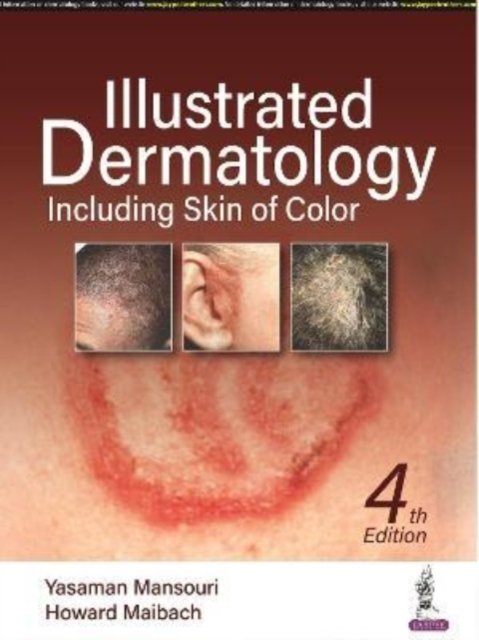 illustrated dermatology free download