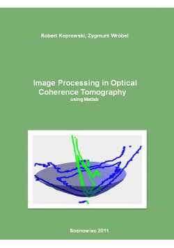 Image Processing in Optical Coherence Tomography - Wydawnictwo ...