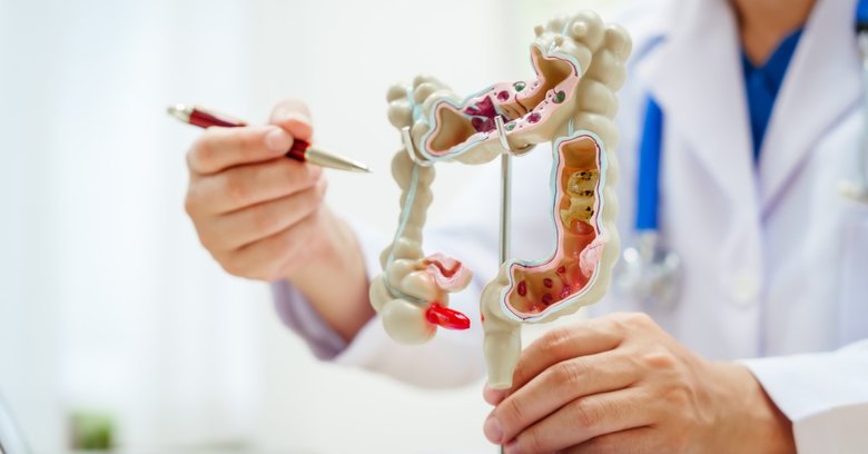 Jak przygotować się do kolonoskopii? Co można jeść przed badaniem, a co po?