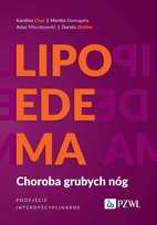 Lipoedema. Choroba grubych nóg. Podejście interdyscyplinarne Artur Mieczkowski, Monika Domagała, Dorota Stettler, Karolina Chęś