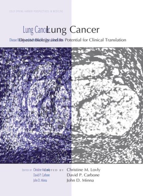 Lung Cancer. Disease Biology And Its Potential For Clinical Translation ...