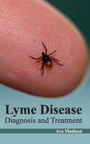 Lyme Disease - M L Books International Pvt Ltd | Książka w Sklepie ...