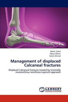 Management of displaced Calcaneal fractures - Zahid Mohd.