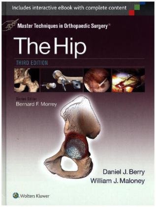 MASTER TECHNIQUES IN ORTHOPAEDIC SURGERY THE HIP PDF DOWNLOAD visual data 7