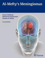 Meningiomas - Demonte Franco, Mcdermott Michael T.