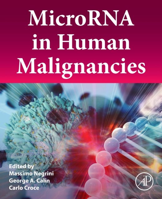 MicroRNA in Human Malignancies - Opracowanie zbiorowe | Książka w Empik