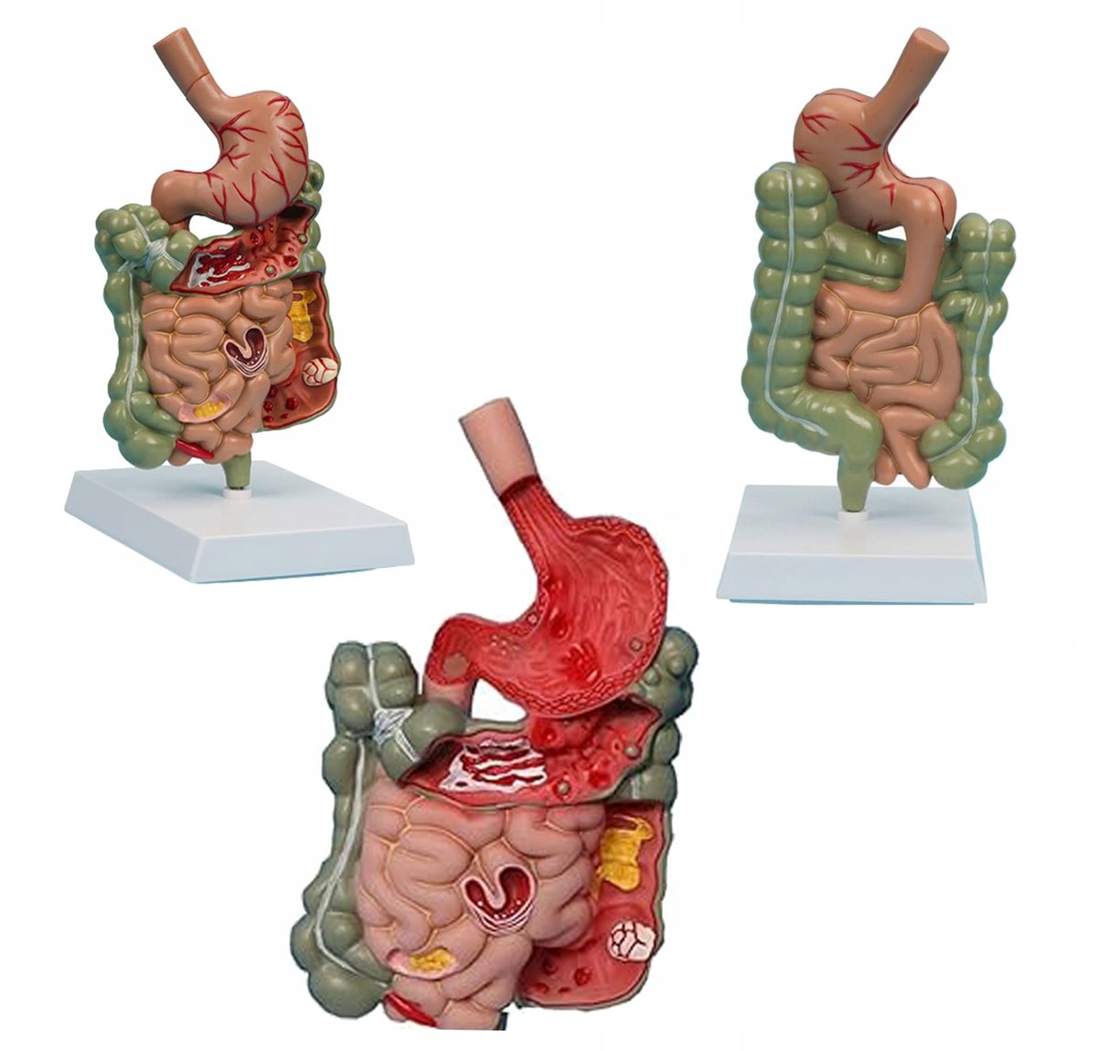 MODEL ANATOMICZNY UKŁADU TRAWIENNEGO CZŁOWIEKA ŻOŁĄDEK JELITO PRZEŁYK ...