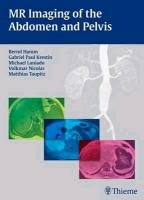 MR Imaging of the Abdomen and Pelvis - Hamm Bernd, Krestin Gabriel Paul, Laniado Michael, Nicolas Volkmar, Taupitz Matthias