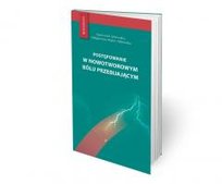 Postępowanie w nowotworowym bólu przebijającym Opracowanie zbiorowe