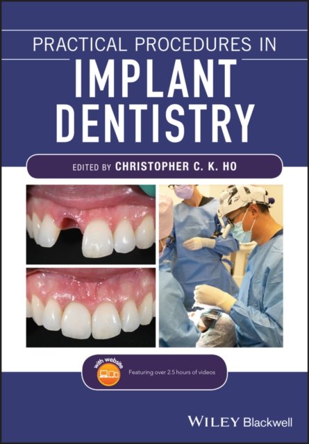 Practical Procedures In Implant Dentistry - Opracowanie Zbiorowe ...