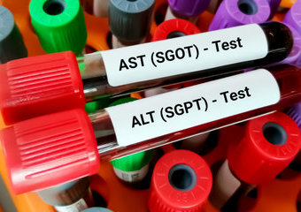 Próby wątrobowe: ALT, AST, GGTP – podwyższone wyniki, normy i badania