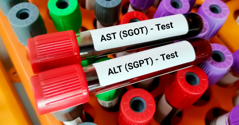 Próby wątrobowe: ALT, AST, GGTP – podwyższone wyniki, normy i badania
