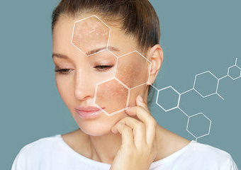 Przebarwienia na twarzy – czym są i jak się ich pozbyć?