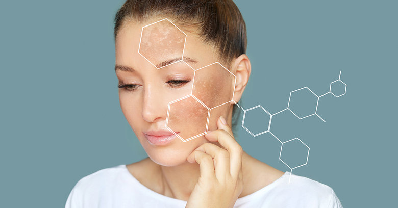 Przebarwienia na twarzy – czym są i jak się ich pozbyć?