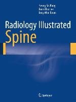 Radiology Illustrated: Spinal Imaging - Kang Heung Sik, Kwon Jong Won, Lee Joon Woo