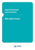Rak szyjki macicy - ebook epub - Wronkowski Zbigniew, Brużewicz Szymon