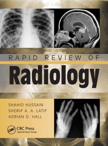 Rapid Review Of Radiology - Opracowanie Zbiorowe | Książka W Empik