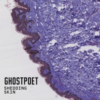 Shedding Skin - Ghostpoet