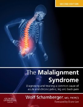 The Malalignment Syndrome - Schamberger Wolf