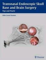 Transnasal Endoscopic Skull Base and Brain Surgery - Stamm Aldo E. C.