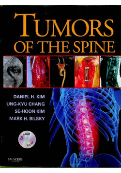 Tumors of the Spine z CD - Opracowanie zbiorowe | Książka w Empik